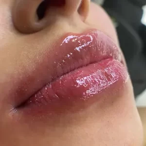 hidrolips